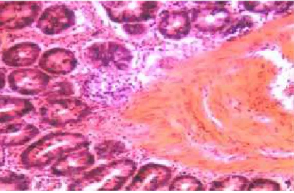 Fig. 1:  Effects of cold stress on histopathologic changes of the intestine  under a light microscope