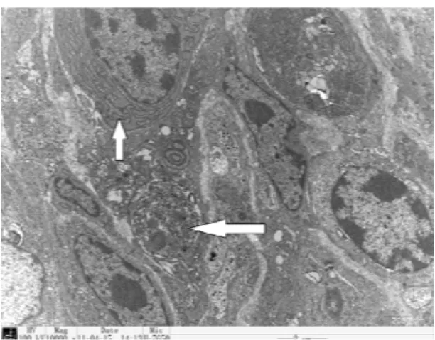 Fig. 2:  Electron microscopic detection after the cold stress. A. The  duodenum in the control birds (10000  × )