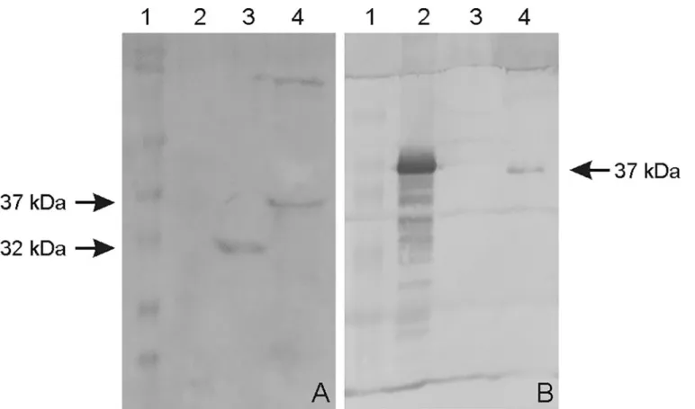 Fig 1. Western blot of recombinant and native OmpL37 proteins. A: rOmpL37 characterization with convalescent human sera