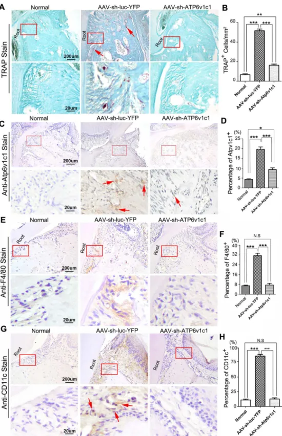 Fig 3. AAV-mediated Atp6v1c1 knockdown decreased TRAP positive cells and Atp6v1c1 expression in the periodontitis lesion area