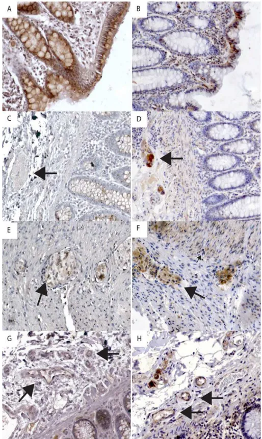 Fig 3. Immunohistochemical staining of melatonin receptors in specific cell types. A) Positive melatonin receptor 1 (MT 1 ) immunoreactivity (IR) in epithelial cells