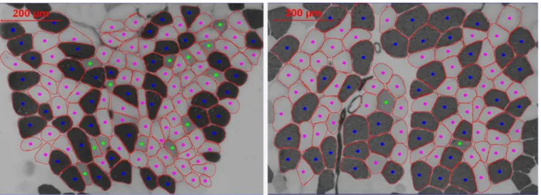 Fig 2. Representative image of fiber type analysis before (left) and after (right) high intensity exercise