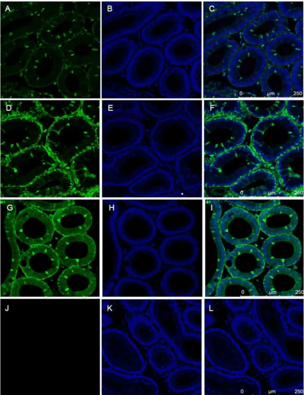 Fig 8. The expression of Venus protein in epididymis from three SB transgenic homozygote mouse strains