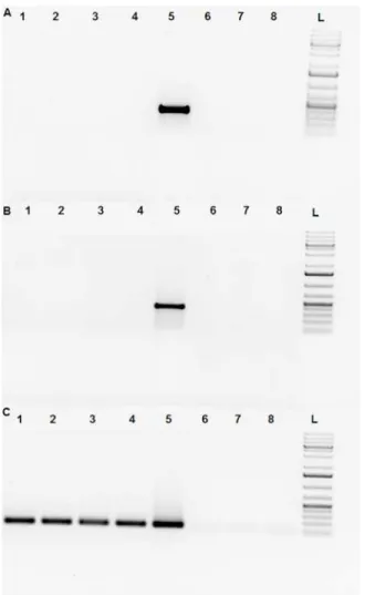 Fig 4. Absence of Venus transcript in SB-CAG-VENUS spermatozoa. The following primer pairs were used in RT-PCR experiments: Fig 4A: YFP Venus specific primer:Forward: 5 ’ GGTCCCTCTTCTCGTTAGGG 3 ’ Reverse: 5 ’ TACAAGACCAGAGCCGAGGT 3 ’ Fig 4B: neonatal rabbi