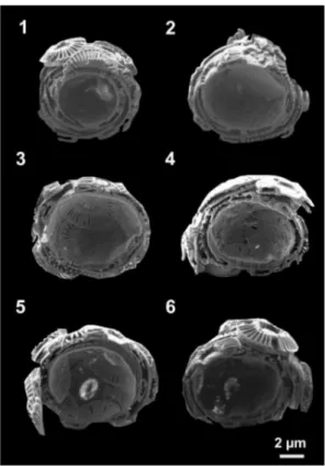 Figure 2. Six exemplary SE images of cross-sections through the coccolithophore species E.