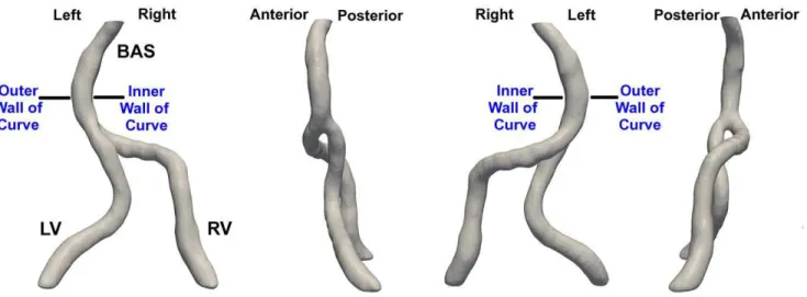 Figure 2. Vertebral artery flow waveforms. Representative mass flow (ml/s) waveform (determined for C)