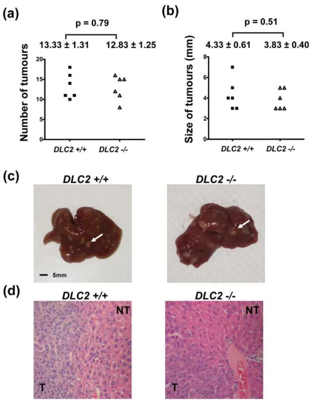 Figure 6. Depletion of DLC2 did not aggravate DEN-induced hepatocarcinogenesis. (a) Number of tumors formed in livers after DEN treatment