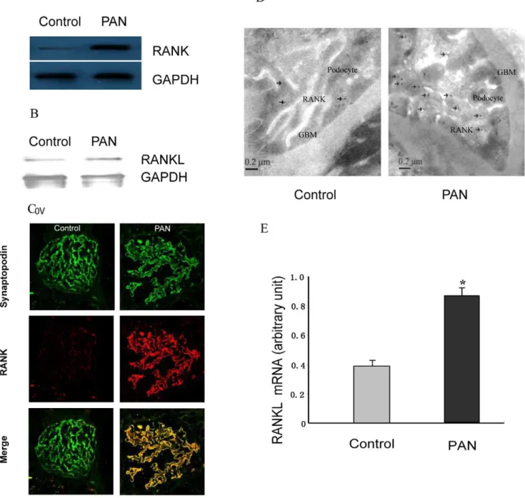 Figure 1. Identification of RANK and RANKL as Upregulation Genes in the Rat Podocyte Injury Model