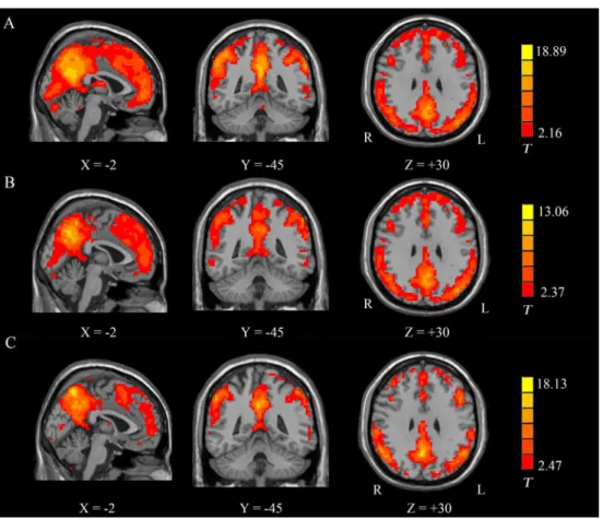 Fig 2. Group-level analyses of the ReHo patterns. (A) HC: healthy controls; (B) PSGC: stroke patients with good cognitive function; (C) PSPC: stroke patients with poor cognitive function