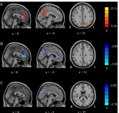 Fig 3. One-way ANOVA and post hoc ReHo analysis results. (A): Detailed regions in the images show differences in ReHo within the DMN between the three groups