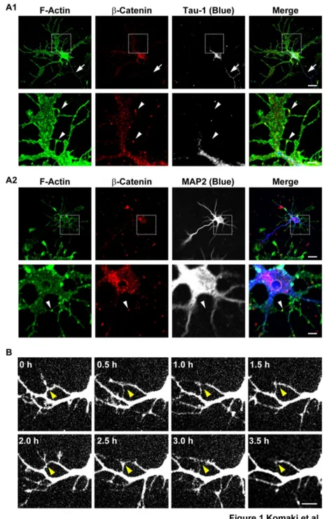 Figure 1.  Transient interactions between dendritic filopodia in cultured hippocampal neurons