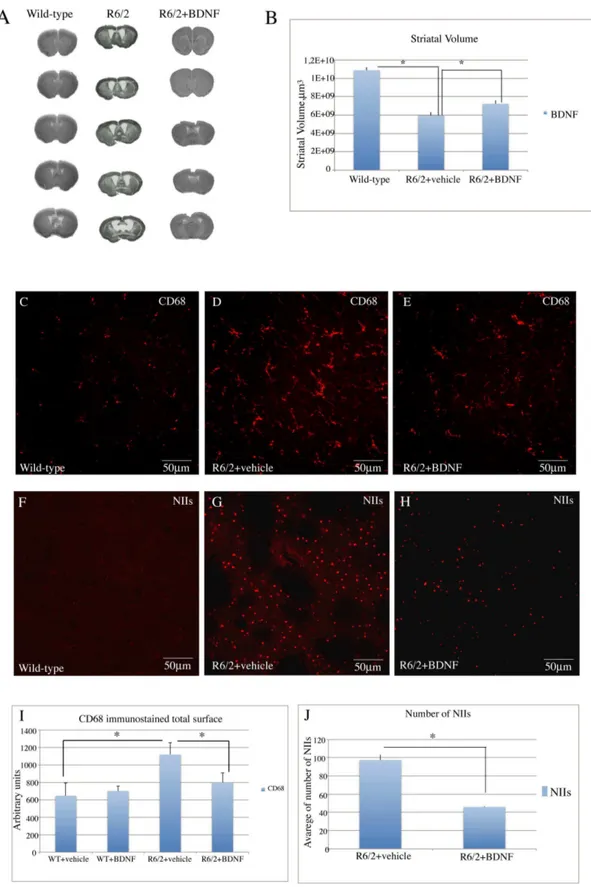 Figure 6. Effects of recombinant BDNF treatment on striatal atrophy in R6/2 mice. Transmitted light microscope images showing representative Nissl-stained coronal sections of a wild-type mouse, a vehicle treated R6/2 mouse and a BDNF-treated R6/2 mouse, (A