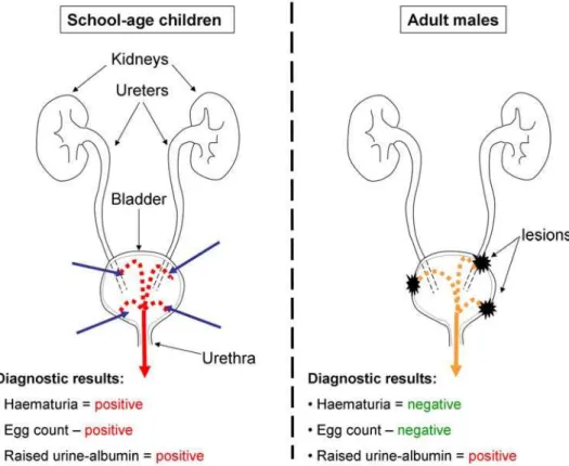 Figure 1. Proposed aetiology of raised urine-albumin levels in school-children and adults