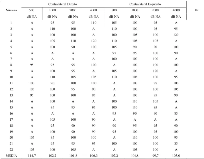 TABLE 3. Distribution and average of the acoustic reflex of the stapedius muscle thresholds of the individuals from group B (n=22).