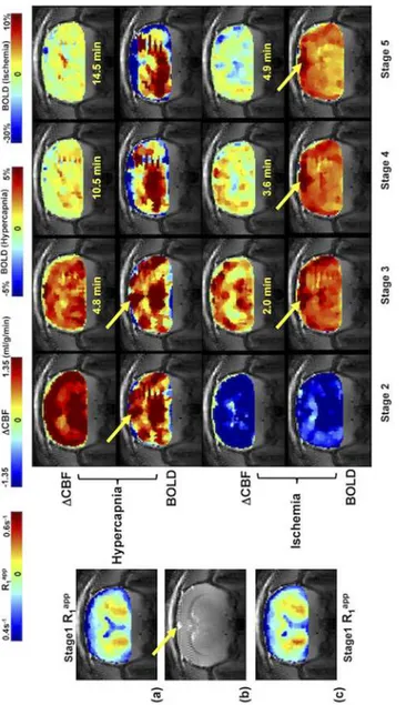 Fig 5 shows the control R 1 app images (coronal orientation) of rat brain, anatomic image, and the Δ CBF and BOLD images measured by the SR-T 1 MRI method during and after the  hyper-capnia/ischemia perturbation in a representative rat without the use of L