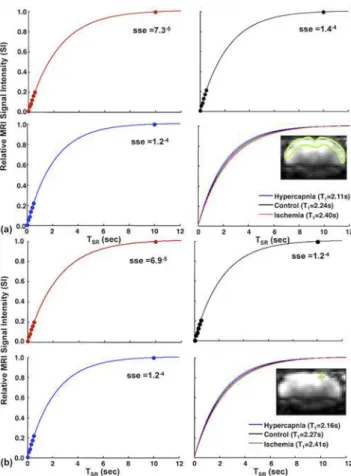 Fig 3 shows the high temporal resolution (~12 s per data point) time courses of relative R 1 CBF