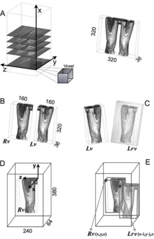 Figure 1. Principal steps involved in the 3D cross-correlation algorithm. a) The 36 slices of the MR sequence, create a 3D volume whose sizes are laterally indicated, b) right volume ( Rv ) and left volumes ( Lv ) separated, c) left reflected volume ( Lrv 