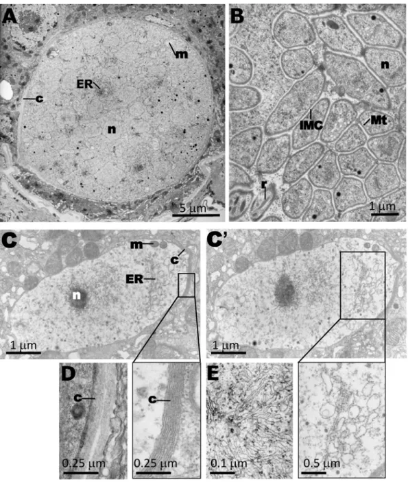 Figure 7. Oocysts of pbggcs 2 parasites: analysis of morphology by transmission electron microscopy