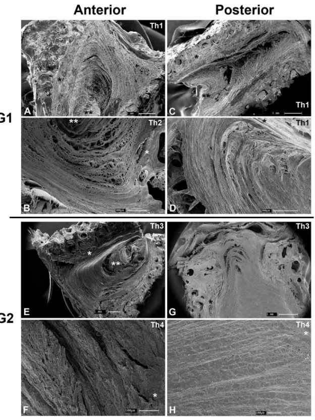 Fig 4. Scanning electron microscopy. G1 (A-D) and G2 (E-H) cervical specimens. AF of G1 composed of alternating lamellae while longitudinal bundles predominate in the posterior AF