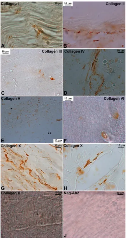 Fig 6. Immunohistochemistry of the different collagen subtypes. Two main patterns were seen: