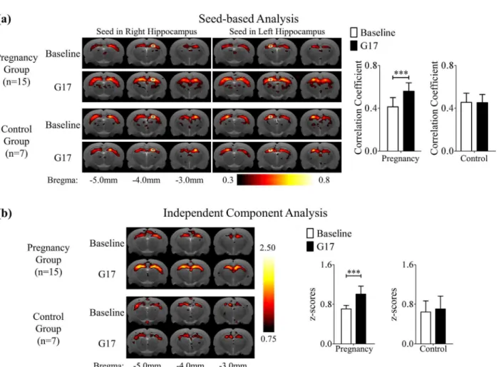 Fig 3. The results of the voxel-based analysis followed by multiple testing corrections via false discovery rate in MD (a) and FA (b) of the