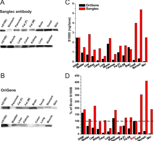 Figure 1. S100B Antibody Comparison. Twelve different types of human tissues were assessed for S100B expression by two different antibodies by Western blot