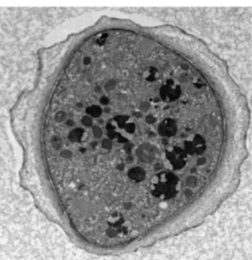 Figure 3.3 - Cyst form of Acanthamoeba (Reproduced from Siddiqui and Khan, 2012). 2