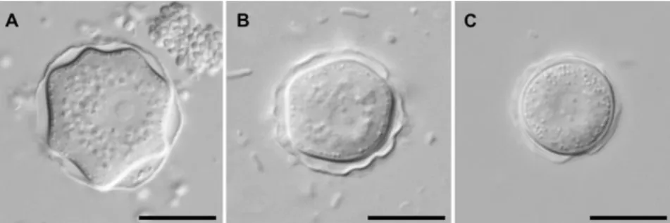 Figure  3.6  -  Acanthamoeba  cysts  in  interference  contrast  microscopy  (A)  morphological  group  I,  (B)  morphological group II, (C) morphological group III