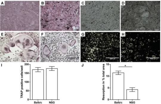Fig 2. Ex vivo analysis of osteoblast and osteoclast function. Osteogenic differentiated primary osteoblasts from Balb/c (A, C) and NOD/scid-IL2Rγ c null