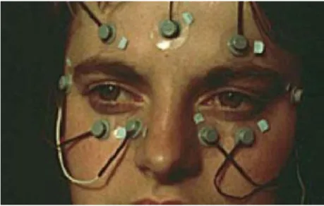 Figura 1.  Electro-OculoGraphy . [3] 