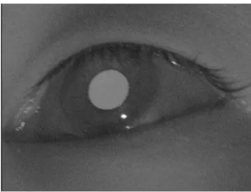 Figura 4. Método  bright pupil . [5] 