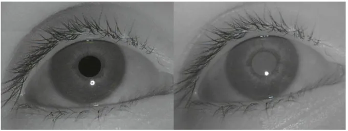 Figura 20.  Dark pupil  (esquerda) e  bright pupil  (direita). 