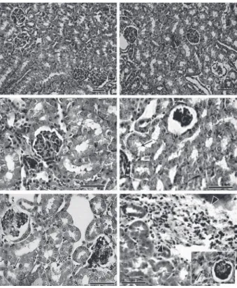 Fig. 3: renal histopathological analysis. BALB/c (left panels) and Fas- Fas-L -/-   mice  (gld/gld)  (right  panels)  were  euthanized  on  zero  (A,  B),  8  (C, D) and 15 (E, F) days post infection with T