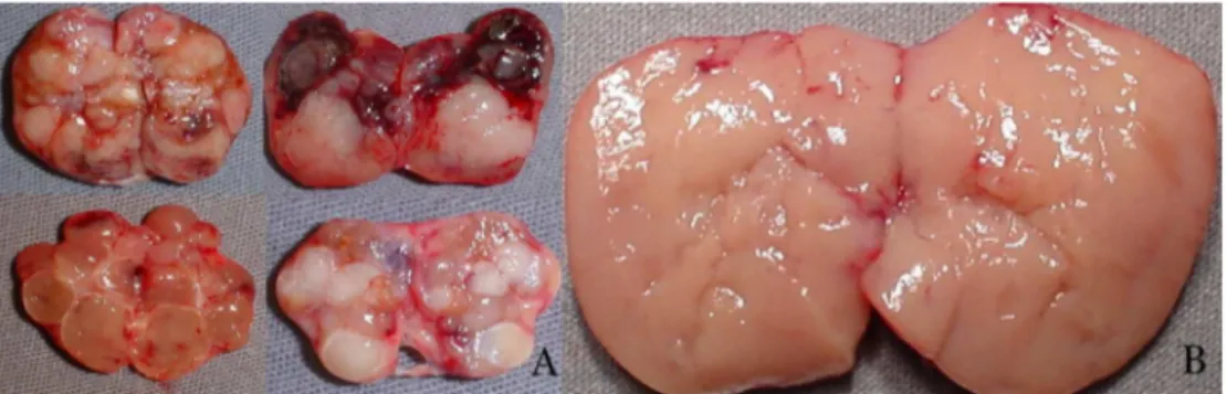 Figure 1 Macroscopic parathyroid tissue observation: A, nodular parathyroid regions not eligible for autotransplantation; B, hyperplasic non-nodular parathyroid area eligible for autotransplantation.