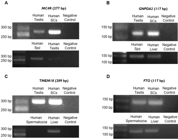 Figure  5:  Identification  of  ORG  in  human  Sertoli  cells  and  spermatozoa  by  conventional  PCR