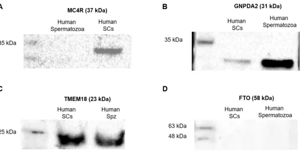 Figure 6: Identification of ORG proteins in human Sertoli cells and spermatozoa by Western-Blot