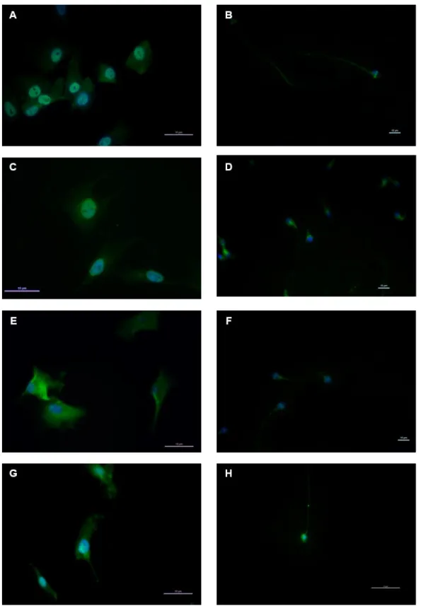 Figure 7: The results of immunofluorescence staining for the studied ORG in human Sertoli Cells  and Spermatozoa
