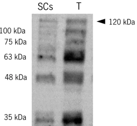 Figure 5. Identification of SIRT1 and its isoforms (35-120 kDa), through Western Blot technique on TM4  Sertoli cells (SCs) and in mouse testicular lysate (T) as positive control