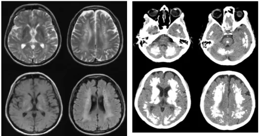 Fig. 2. The CT of the patient’s head.