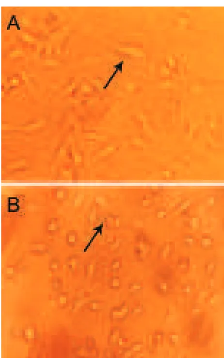 Fig 1: Schwann cells and bone marrow stromal cells in cul- cul-ture. (A) Schwann cells (×200) and (B) bone marrow stromal  cells are shown in late stage of subculture (× 200) .