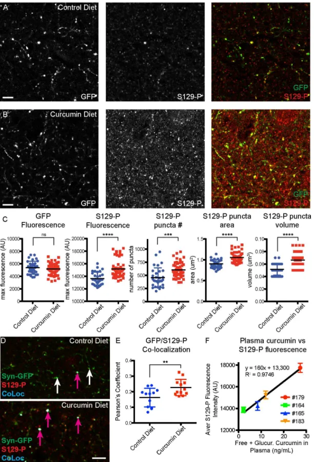 Fig 4. Increased S129-P- α -synuclein in curcumin diet mice. Immunohistochemical detection of S129-P-α-synuclein in cortical tissue from control (A) and curcumin (B) diet mice