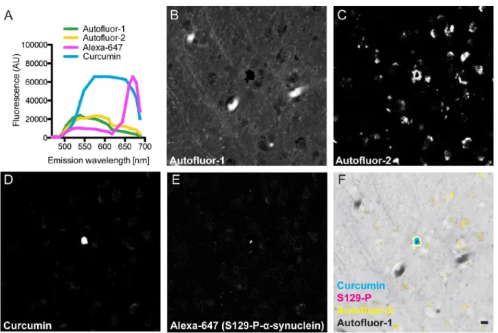 Fig 1. Curcumin stains Lewy Bodies. (A) Individual fluorescence spectra of curcumin, Alexa-647 secondary antibody, and two autofluorescent