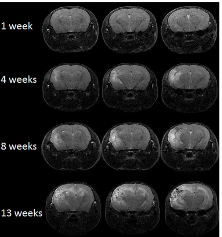 Fig 2. MRI can monitor radiation necrosis in irradiated mouse brain. Representative contrast-enhanced, transaxial T2-weighted spin-echo images of irradiated mice at 1, 4, 8, and 13 weeks following a single 50-Gy (50% isodose) of radiation