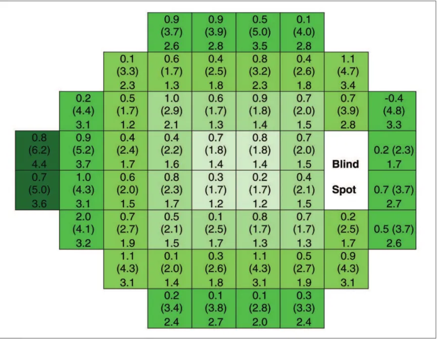 Figure 2 - Spatial distribution of the variation in the threshold sensitivity in the 52 points tested in the standard automated perimetry