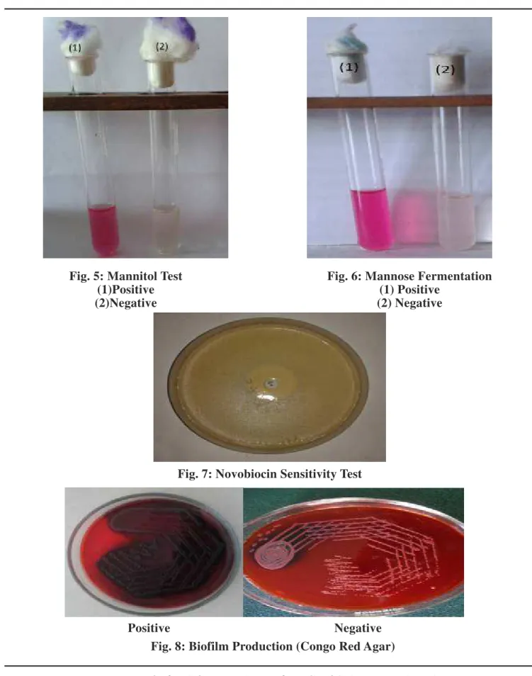 Fig. 5: Mannitol Test                                                        