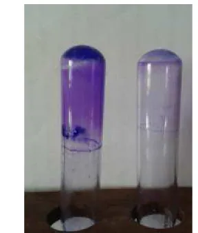 Fig. 10: Antibiotic Susceptibility Test
