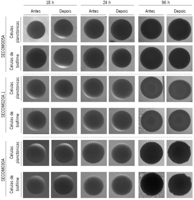 Figura  8.  Evolução  morfológica  das  colónias  das  células  planctónicas  e  de  biofilme,  das  estirpes  comensais, antes e após 180 min de incubação com sangue humano, após incubação da placa de  TSA durante 18, 24 e 96 h a 37 °C