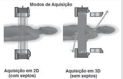 Figure 1. 2D and 3D acquisition modes. Schematic representation of 2D and 3D acquisition modes demonstrating the positioning of the septa and lines of response