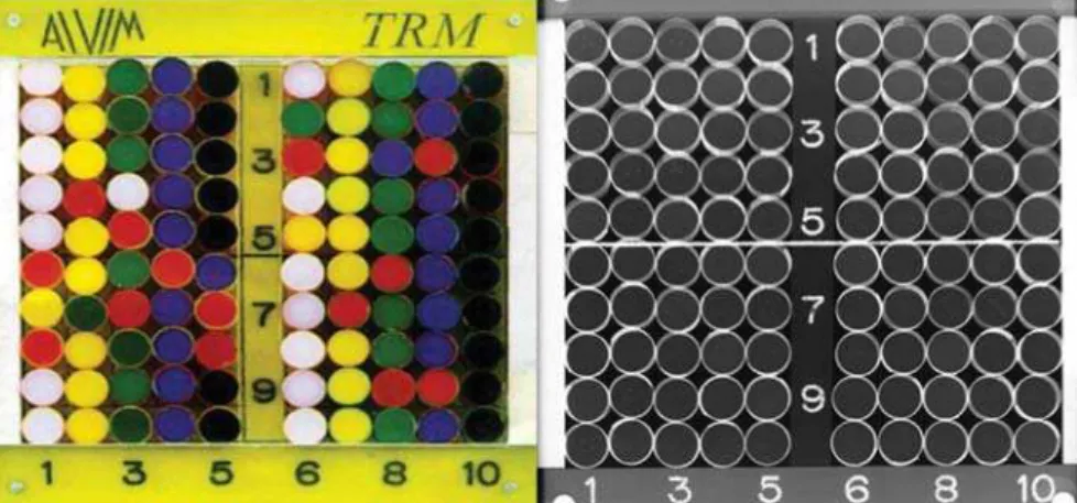 Figure 1. Alvim ®  statistical phantom (at left) and respective radiographic image (at right).