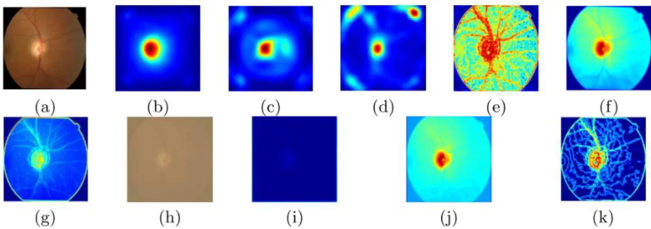 Figure 3-9 Local and global saliency maps obtained through the methods [5-7] and the authors' method  Mahapatra  (adapted from [26])